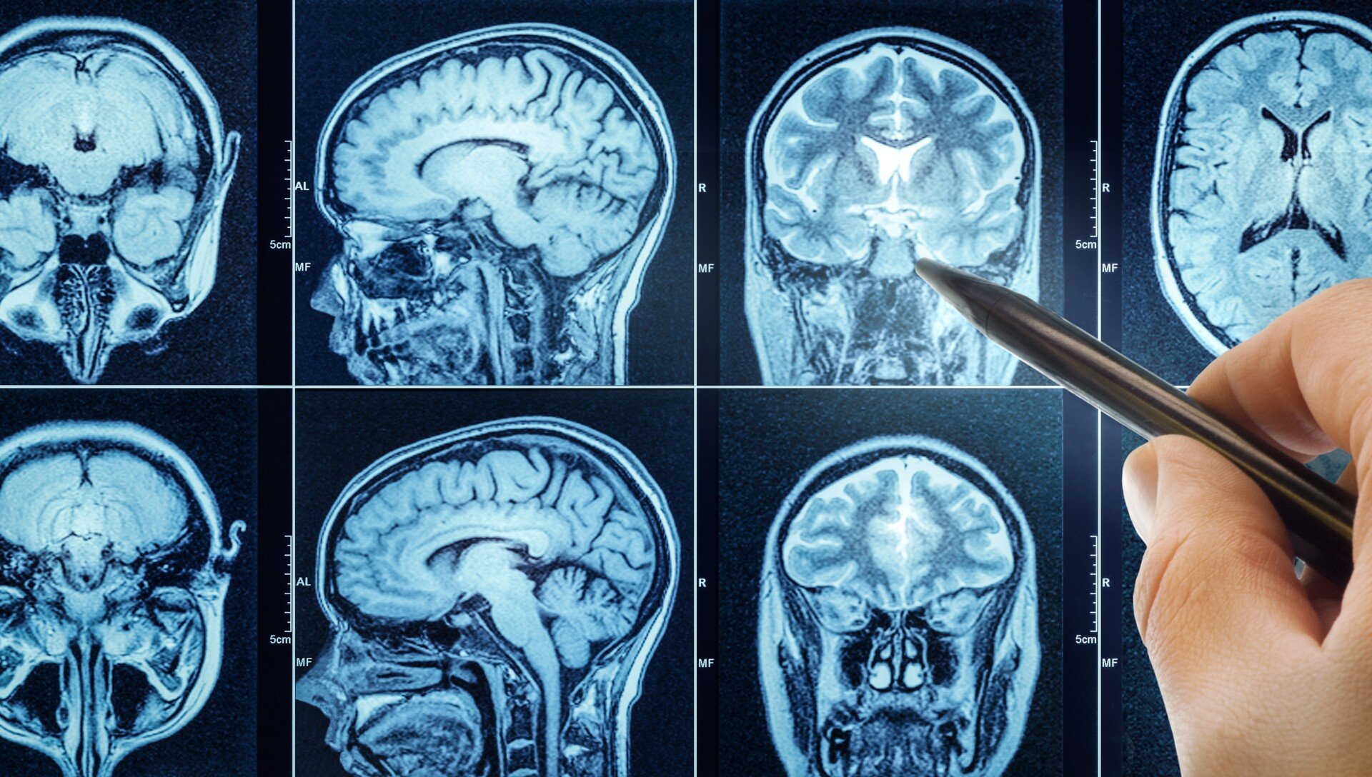 Ct,Scan,With,Brain,And,Doctor's,Hand.,Medical,,Science,And brain scan image
