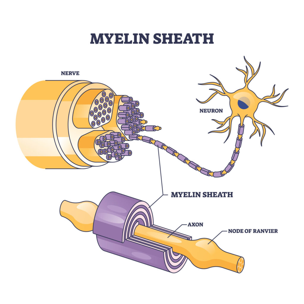 Demyelination: Symptoms, Causes, Diagnosis, Treatment 2 myelin sheath