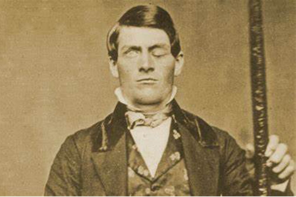 phineas gage1